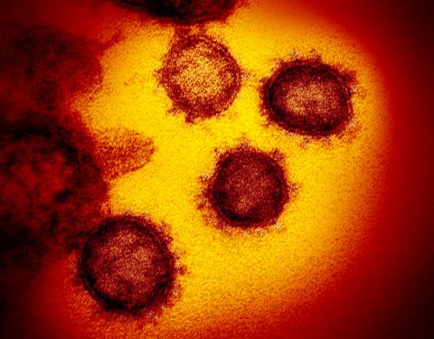   Transmission electron microscope image of SARS-CoV-2, the virus that causes COVID-19, emerging from human cells. Credit: NIAID