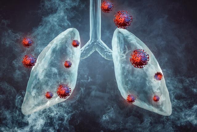 COVID lungs. Getty Images.